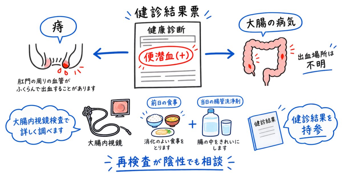 50代女性の便潜血陽性、痔でも？東浦町で精密検査を相談する目安